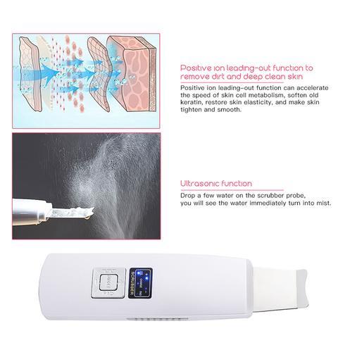 Image of Ultrasonic Skin Scrubber Face Cleanser Blackhead Acne Removal Facial Spa Vibration Massager Ultrasound Peeling Clean Machine 394