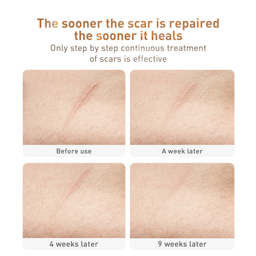 Traditional Chinese Medicine Scar Removal Cream Care Cream