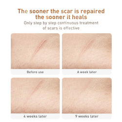Image of Traditional Chinese Medicine Scar Removal Cream Care Cream