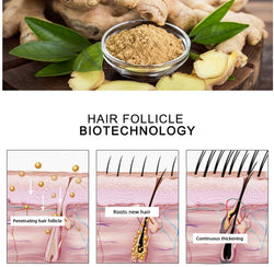 Image of Hair Growth Oil Hair Growth Oil Oem Hair Care Essential Oil