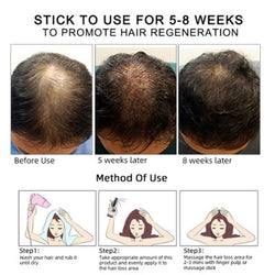 Image of Hair Growth Oil Hair Growth Oil Oem Hair Care Essential Oil