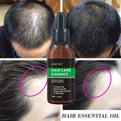 Image of Hair Growth Oil Hair Growth Oil Oem Hair Care Essential Oil