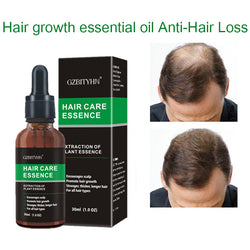 Image of Hair Growth Oil Hair Growth Oil Oem Hair Care Essential Oil