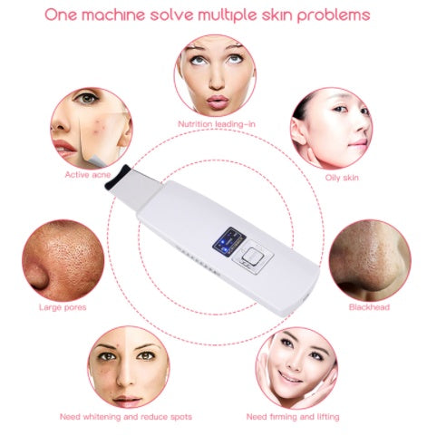 Image of Ultrasonic Skin Scrubber Face Cleanser Blackhead Acne Removal Facial Spa Vibration Massager Ultrasound Peeling Clean Machine 394