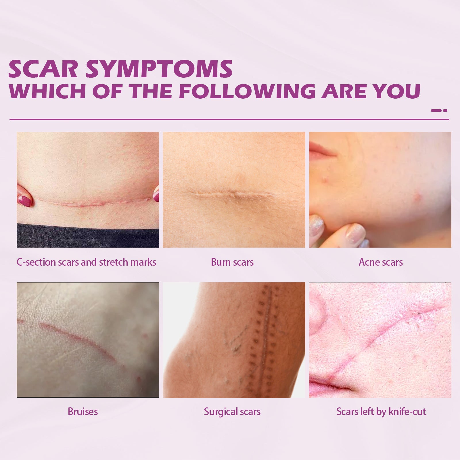 Fade Scars Skin Care Moisturizing Smooth Skin Facial Neck