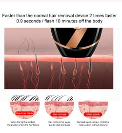 Image of Beauty laser hair removal machine professional whitening