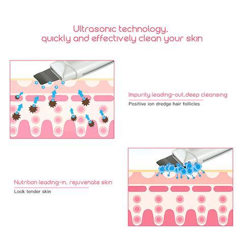 Image of Ultrasonic Skin Scrubber Face Cleanser Blackhead Acne Removal Facial Spa Vibration Massager Ultrasound Peeling Clean Machine 394
