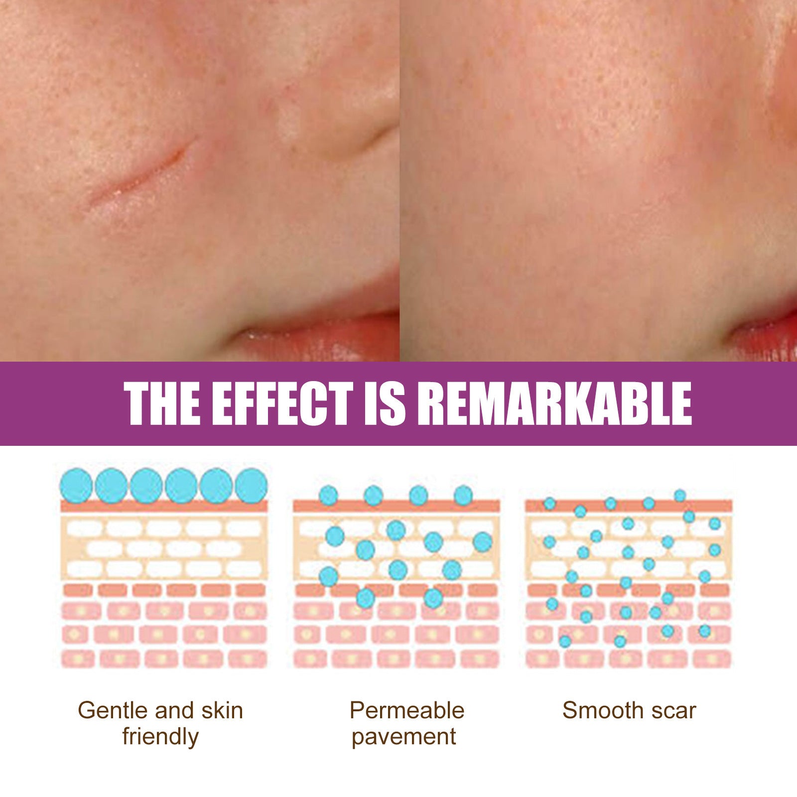 Fade Scars Skin Care Moisturizing Smooth Skin Facial Neck